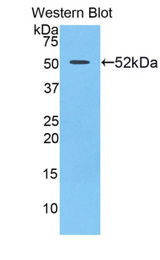 Western blot of recombinant UPRT.