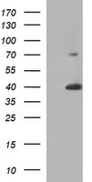HEK293T cells were transfected with the pCMV6-ENTRY control (Left lane) or pCMV6-ENTRY UPRT (Right lane) cDNA for 48 hrs and lysed. Equivalent amounts of cell lysates (5 ug per lane) were separated by SDS-PAGE and immunoblotted with anti-UPRT.
