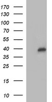 HEK293T cells were transfected with the pCMV6-ENTRY control (Left lane) or pCMV6-ENTRY UPRT (Right lane) cDNA for 48 hrs and lysed. Equivalent amounts of cell lysates (5 ug per lane) were separated by SDS-PAGE and immunoblotted with anti-UPRT.