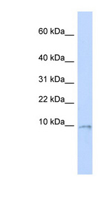 UQCR10 / UCRC antibody LS-C102102 Western blot of MCF7 cell lysate.