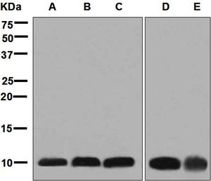 Western blot analysis on (A) MCF-7, (B) HepG2, (C) HeLa, (D) fetal heart, and (E) human skeletal muscle lysates using anti-UQCR10 / UCRC antibody.