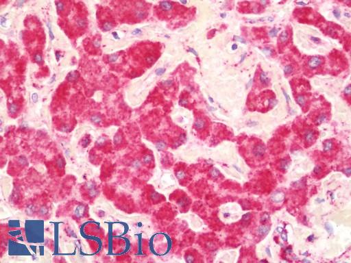 Anti-UQCRC1 antibody IHC staining of human liver. Immunohistochemistry of formalin-fixed, paraffin-embedded tissue after heat-induced antigen retrieval. Antibody LS-B11400 concentration 10 ug/ml.