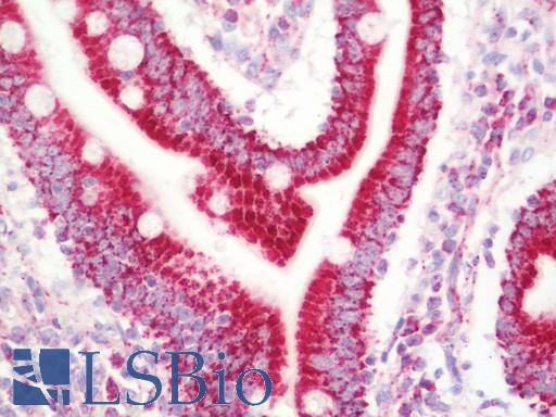 Anti-UQCRC1 antibody IHC staining of human small intestine. Immunohistochemistry of formalin-fixed, paraffin-embedded tissue after heat-induced antigen retrieval.