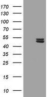 HEK293T cells were transfected with the pCMV6-ENTRY control (Left lane) or pCMV6-ENTRY UQCRC1 (Right lane) cDNA for 48 hrs and lysed. Equivalent amounts of cell lysates (5 ug per lane) were separated by SDS-PAGE and immunoblotted with anti-UQCRC1.