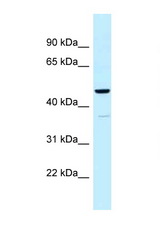 UQCRC1 antibody LS-C145874 Western blot of Fetal Kidney lysate. Antibody concentration 1 ug/ml.