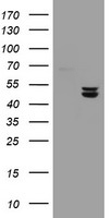 HEK293T cells were transfected with the pCMV6-ENTRY control (Left lane) or pCMV6-ENTRY UQCRC1 (Right lane) cDNA for 48 hrs and lysed. Equivalent amounts of cell lysates (5 ug per lane) were separated by SDS-PAGE and immunoblotted with anti-UQCRC1.