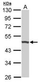 Sample (50 ug of whole cell lysate). A: Mouse brain. 10% SDS PAGE. UQCRC1 antibody diluted at 1:1000.