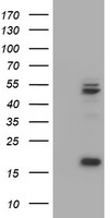 HEK293T cells were transfected with the pCMV6-ENTRY control (Left lane) or pCMV6-ENTRY UQCRC1 (Right lane) cDNA for 48 hrs and lysed. Equivalent amounts of cell lysates (5 ug per lane) were separated by SDS-PAGE and immunoblotted with anti-UQCRC1.