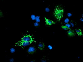 Anti-UQCRC1 mouse monoclonal antibody immunofluorescent staining of COS7 cells transiently transfected by pCMV6-ENTRY UQCRC1.