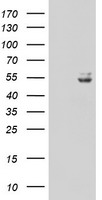 HEK293T cells were transfected with the pCMV6-ENTRY control (Left lane) or pCMV6-ENTRY UQCRC1 (Right lane) cDNA for 48 hrs and lysed. Equivalent amounts of cell lysates (5 ug per lane) were separated by SDS-PAGE and immunoblotted with anti-UQCRC1.