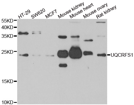 Western blot analysis of extracts of various cell lines, using UQCRFS1 antibody.
