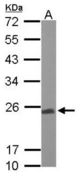 Sample (50 ug of whole cell lysate). A: Mouse brain. 12% SDS PAGE. UQCRFS1 antibody diluted at 1:1000.