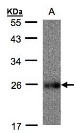Sample (30 ug whole cell lysate). A: Raji. 12% SDS PAGE. UQCRFS1 antibody diluted at 1:500