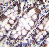 UQCRFS1 Antibody immunohistochemistry of formalin-fixed and paraffin-embedded human rectum tissue followed by peroxidase-conjugated secondary antibody and DAB staining.
