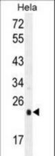 UQCRFS1 Antibody western blot of HeLa cell line lysates (35 ug/lane). The UQCRFS1 antibody detected the UQCRFS1 protein (arrow).