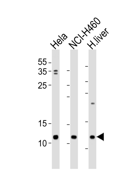 Western blot of lysates from HeLa, NCI-H460 cell line and human liver tissue lysate (from left to right) with UQCRQ Antibody. Antibody was diluted at 1:1000 at each lane. A goat anti-rabbit IgG H&L (HRP) at 1:5000 dilution was used as the secondary antibody. Lysates at 35 ug per lane.