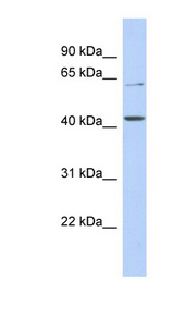 SLC22A12 antibody LS-C110859 Western blot of DU145 cell lysate.
