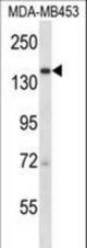 Urb2 Antibody western blot of MDA-MB453 cell line lysates (35 ug/lane). The Urb2 antibody detected the Urb2 protein (arrow).