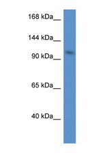 URGCP / URG4 antibody LS-C135377 Western blot of Mouse Heart lysate. Antibody concentration 1 ug/ml.