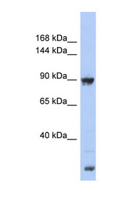 URGCP / URG4 antibody LS-C111874 Western blot of Fetal Muscle lysate.