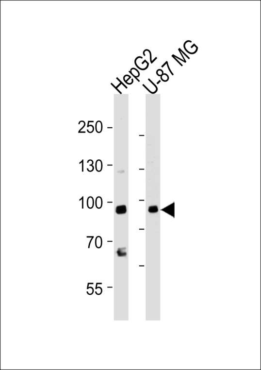 Western blot of lysates from HepG2, U-87 MG cell line (from left to right), using URG4 Antibody. Antibody was diluted at 1:1000 at each lane. A goat anti-rabbit IgG H&L (HRP) at 1:5000 dilution was used as the secondary antibody. Lysates at 35ug per lane.