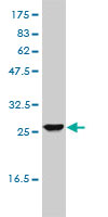UROS monoclonal antibody (M01), clone 1E11-B11 Western Blot analysis of UROS expression in HL-60.