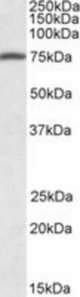 FERMT3 antibody (1 ug/ml) staining of Human Peripheral Blood Mononucleocytes lysate (35 ug protein in RIPA buffer). Primary incubation was 1 hour. Detected by chemiluminescence.