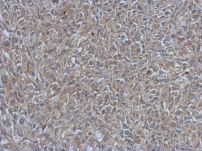 IHC of paraffin-embedded RT2 xenograft, using URP2 antibody at 1:500 dilution.