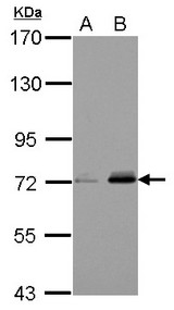 Sample (30 ug of whole cell lysate) A: Jurkat B: Raji 7.5% SDS PAGE FERMT3 / URP2 antibody diluted at 1:1000