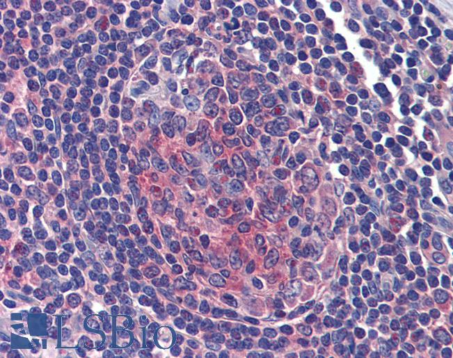 Anti-FERMT3 / URP2 antibody IHC of human tonsil. Immunohistochemistry of formalin-fixed, paraffin-embedded tissue after heat-induced antigen retrieval. Antibody LS-B3808 concentration 5 ug/ml.