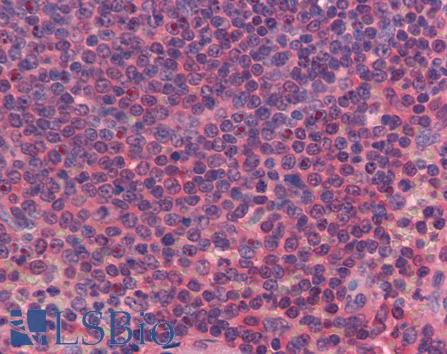 Anti-FERMT3 / URP2 antibody IHC of human spleen. Immunohistochemistry of formalin-fixed, paraffin-embedded tissue after heat-induced antigen retrieval. Antibody LS-B3808 concentration 5 ug/ml.
