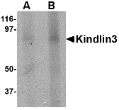 Western blot of KINDLIN3 in rat spleen lysate with KINDLIN3 antibody at (A) 1 and (B) 2 ug/ml.