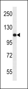 USO1 Antibody western blot of ZR-75-1 cell line lysates (35 ug/lane). The USO1 antibody detected the USO1 protein (arrow).