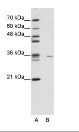 A: Marker, B: Jurkat Cell Lysate