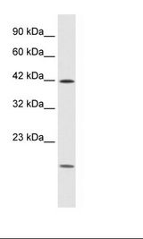 Jurkat Cell Lysate