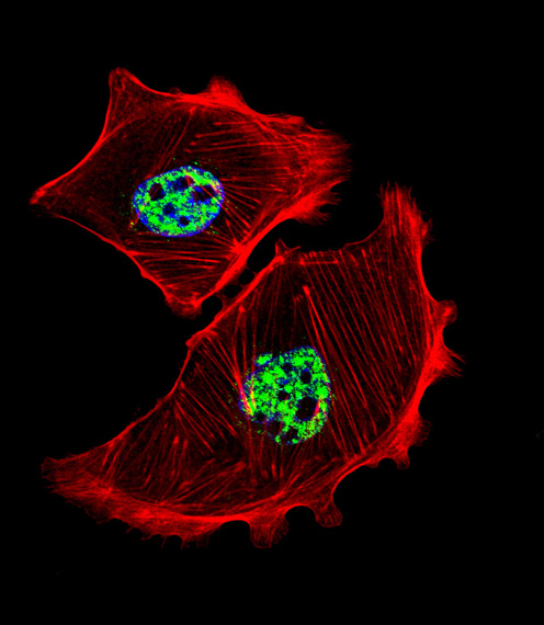 Fluorescent confocal image of SK-BR-3 cell stained with USF1 Antibody. SK-BR-3 cells were fixed with 4% PFA (20 min), permeabilized with Triton X-100 (0.1%, 10 min), then incubated with USF1 primary antibody (1:25, 1 h at 37°C). For secondary antibody, Alexa Fluor 488 conjugated donkey anti-rabbit antibody (green) was used (1:400, 50 min at 37°C). Cytoplasmic actin was counterstained with Alexa Fluor 555 (red) conjugated Phalloidin (7units/ml, 1 h at 37°C). Nuclei were counterstained with DAPI (blue) (10 ug/ml, 10 min). USF1 immunoreactivity is localized to nucleus significantly.