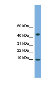 USMG5 antibody LS-C117156 Western blot of Fetal Heart lysate.
