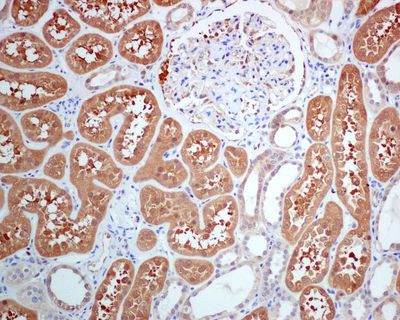 IHC of paraffin-embedded human kidney tissue using anti-USP10 antibody.