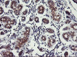 IHC of paraffin-embedded Human breast tissue using anti-USP10 mouse monoclonal antibody.