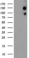 HEK293T cells were transfected with the pCMV6-ENTRY control (Left lane) or pCMV6-ENTRY USP10 (Right lane) cDNA for 48 hrs and lysed. Equivalent amounts of cell lysates (5 ug per lane) were separated by SDS-PAGE and immunoblotted with anti-USP10.