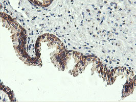 IHC of paraffin-embedded Human prostate tissue using anti-USP10 mouse monoclonal antibody.