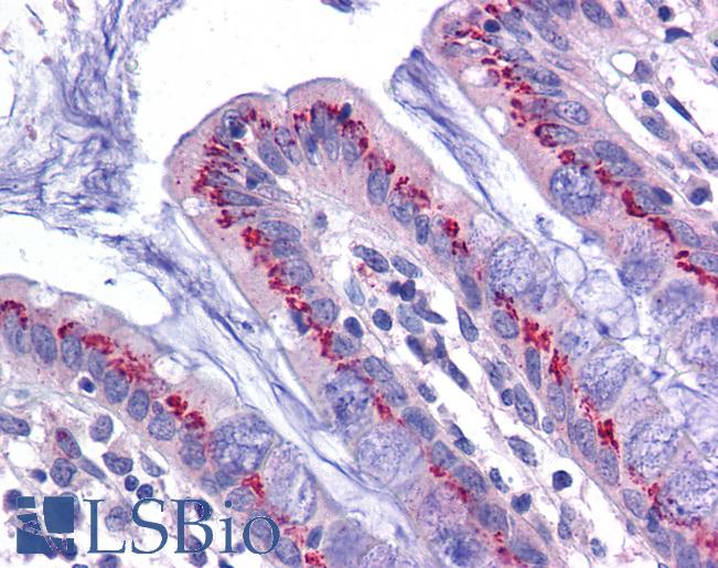 Anti-USP10 antibody IHC of human colon. Immunohistochemistry of formalin-fixed, paraffin-embedded tissue after heat-induced antigen retrieval. Antibody LS-B5278 concentration 5 ug/ml.