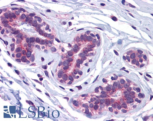 Anti-USP10 antibody IHC of human breast. Immunohistochemistry of formalin-fixed, paraffin-embedded tissue after heat-induced antigen retrieval. Antibody LS-B5278 concentration 5 ug/ml.