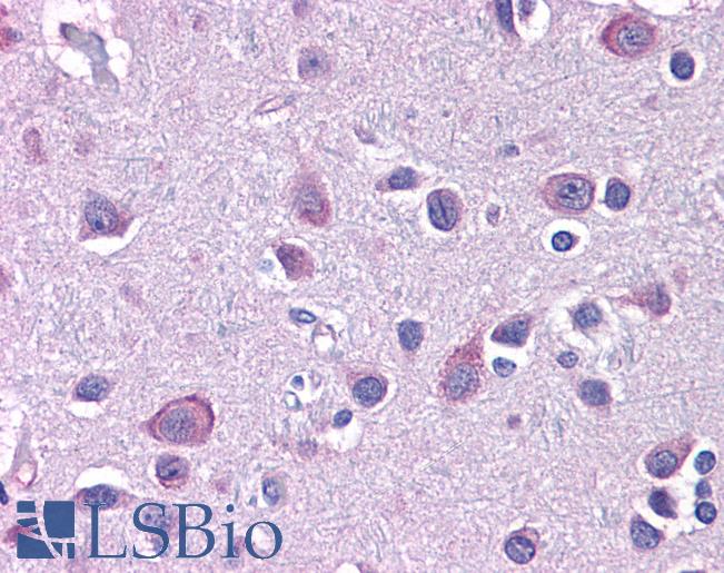 Anti-USP10 antibody IHC of human brain, cortex. Immunohistochemistry of formalin-fixed, paraffin-embedded tissue after heat-induced antigen retrieval. Antibody LS-B5278 concentration 5 ug/ml.