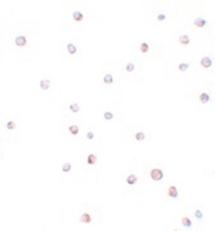 Immunocytochemistry of USP10 in Jurkat cells with USP10 antibody at 20 ug/ml.