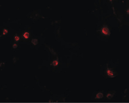 Immunofluorescence of USP10 in Jurkat cells with USP10 antibody at 20 ug/ml.