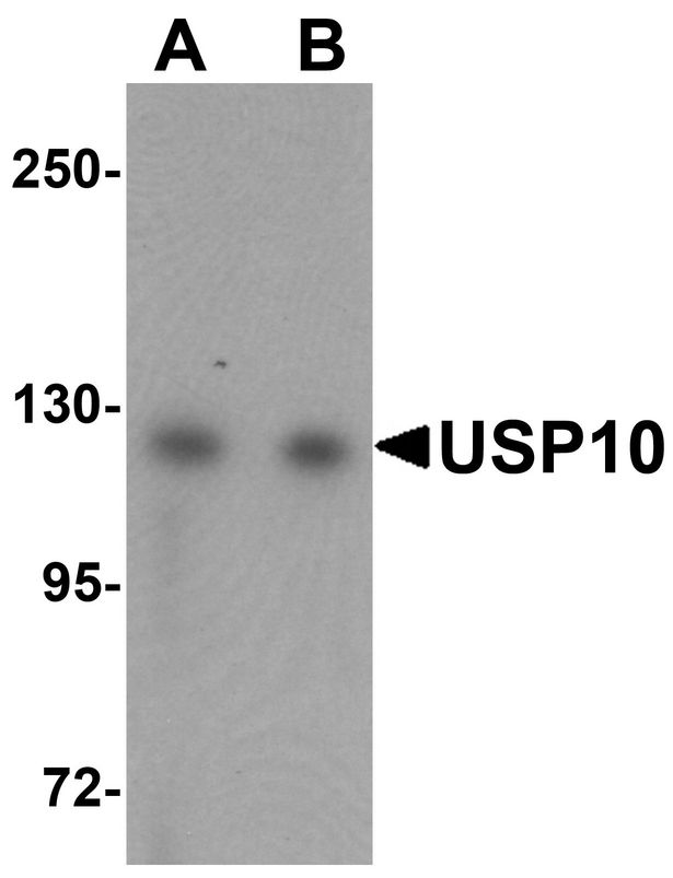 Western blot analysis of USP10 in Jurkat cell lysate with USP10 antibody at (A) 1 and (B) 2 ug/ml.