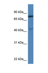 USP10 antibody LS-C145246 Western blot of Rat Lung lysate. Antibody concentration 1 ug/ml.