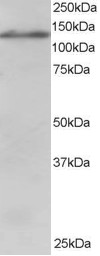 Antibody staining (1 ug/ml) of Jurkat lysate (RIPA buffer, 30 ug total protein per lane). Primary incubated for 1 hour. Detected by Western blot of chemiluminescence.