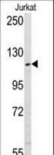 Western blot of anti-USP11 antibody in Jurkat cell line lysates (35 ug/lane). USP11(arrow) was detected using the purified antibody.